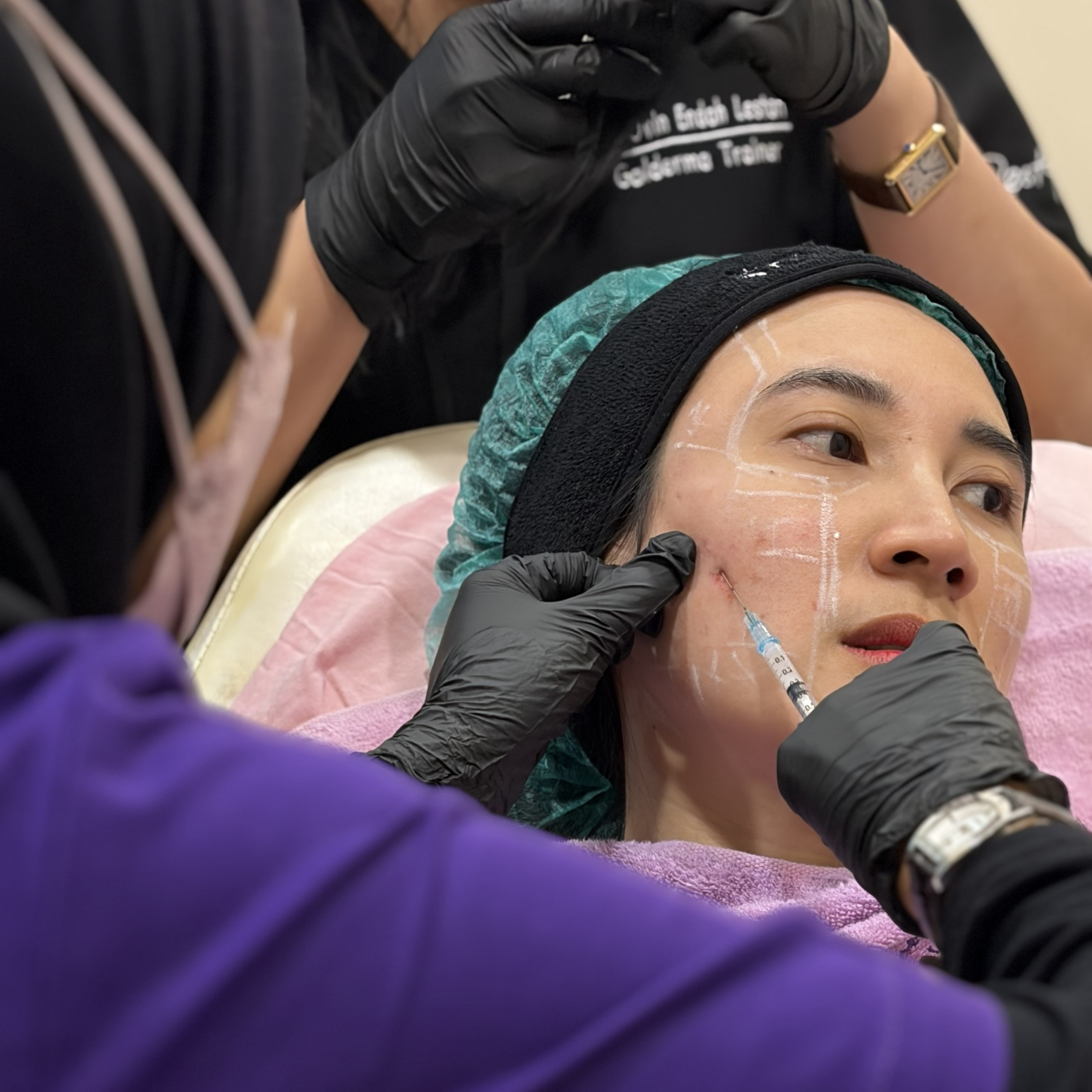 Mengapa Collagen Stimulator Seperti Sculptra Jadi Tren Anti-Aging Saat Ini?