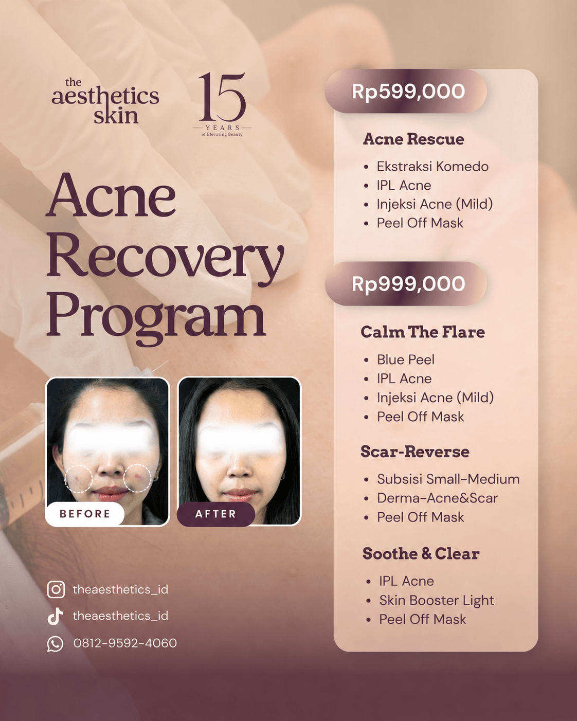 Acne Recovery Program The Aesthetics Skin